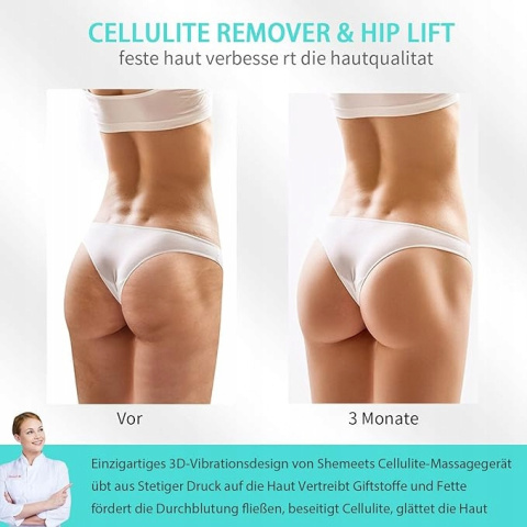 Masażer cellulitu ASD-01 - skuteczna terapia w domu Masażer cellulitu ASD-01 - skuteczna terapia w domu